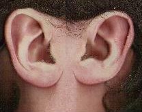 oreilles